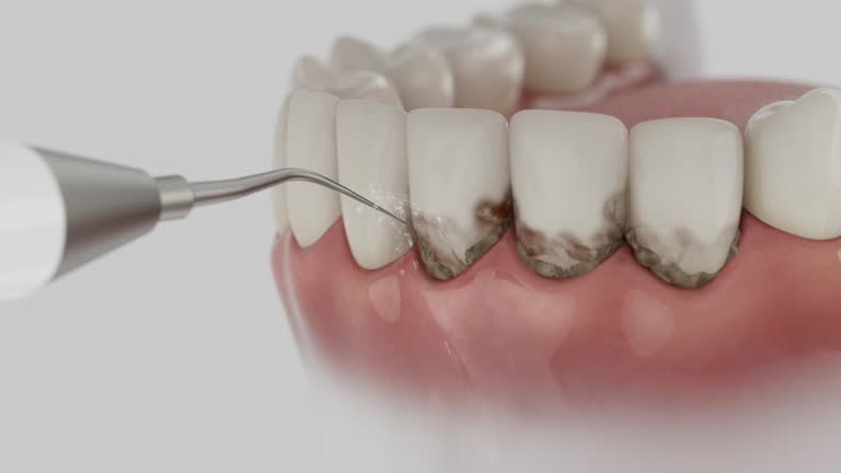 Trusted Tooth Extraction service in Kinston, NC - Dentist Open Now